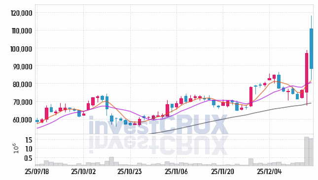 메지온 주가 전망 핵심 자료, 오늘의 특징주 주가 차트 분석 2025.12.17